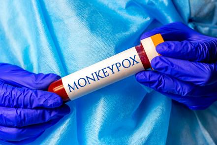 Monkeypox