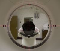agy hiányzó agyfélteke mri felvétel vizsgálat neurológia agy hiányzó agyfélteke mri felvétel vizsgálat neurológia