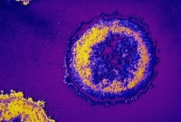 HIV, vírus, fertőzés