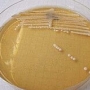 Candida albicans Candida albicans