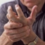 rheumatoid arthritis rheumatoid arthritis